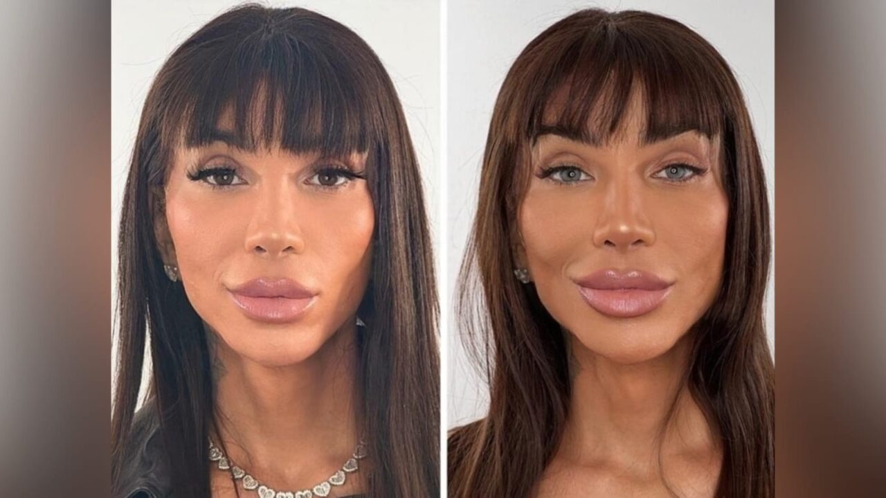 Cirurgia que muda a cor dos olhos é arriscada e não deve ser feita por estética, alerta CBO