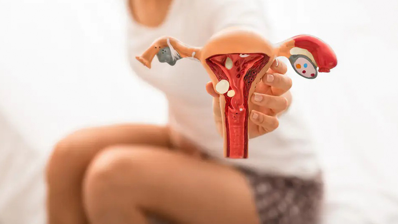 Câmara aprova criação da Semana Municipal de Enfrentamento à Endometriose