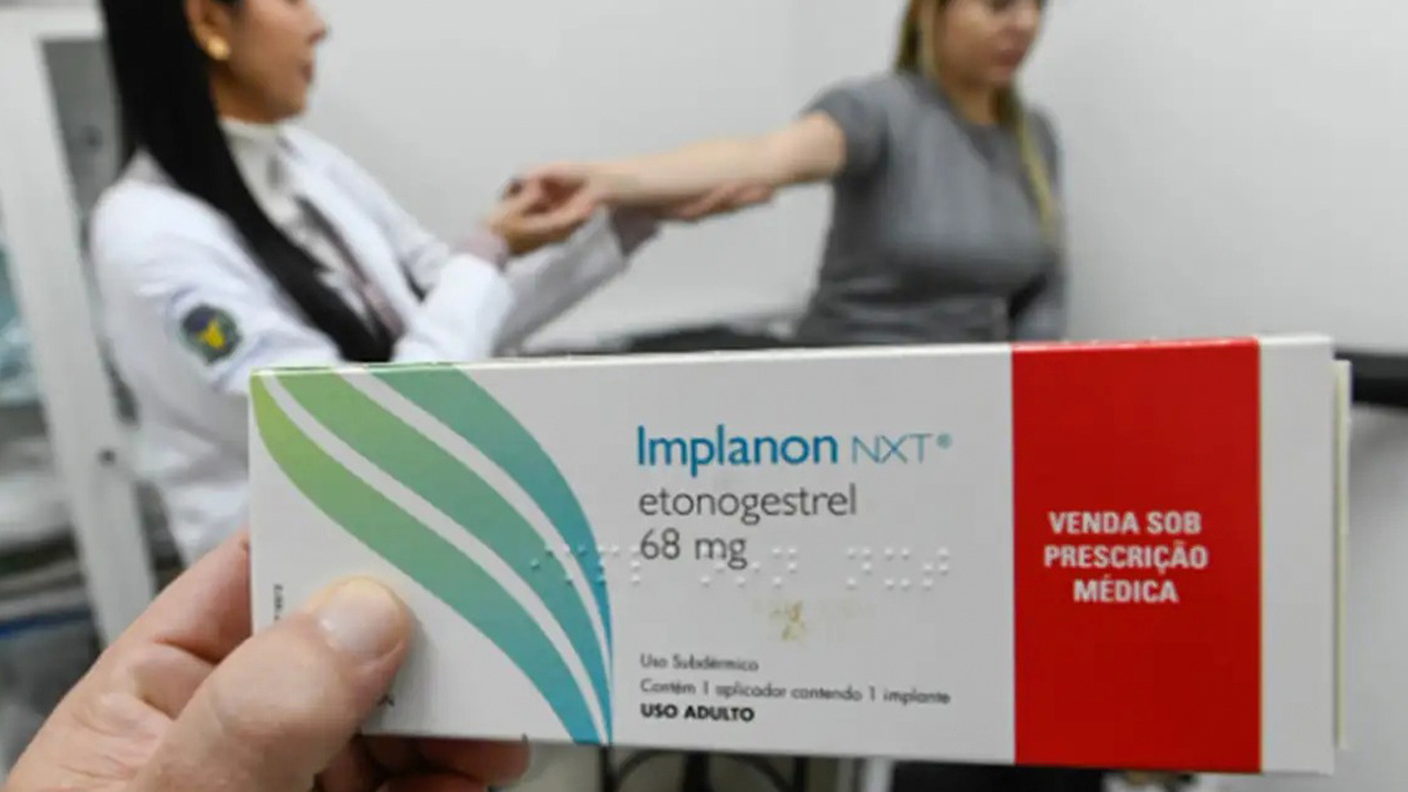 Implante contraceptivo passa a ser oferecido por planos de saúde